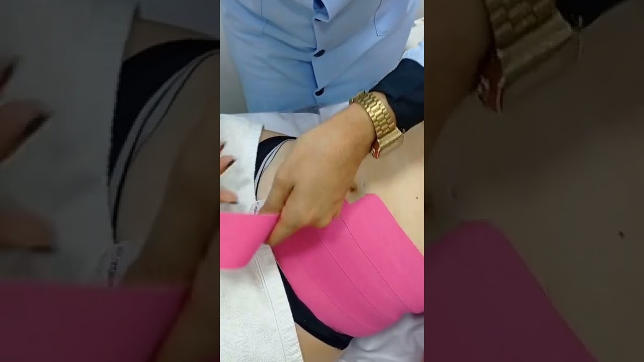 Taping no Transoperatório