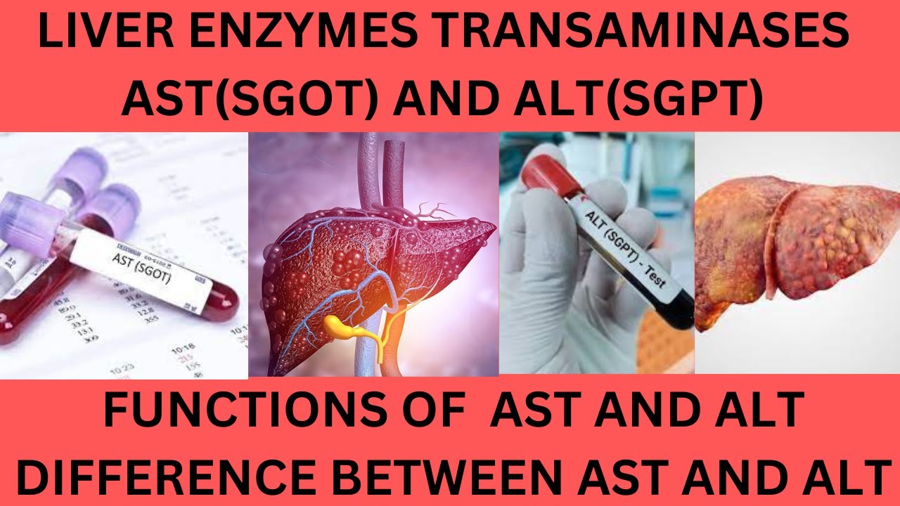 LIVER TRANSAMINASES AST (SGOT) AND ALT(SGPT).NORMAL RANGES .FUNCTIONS AND  CAUSES OF HIGH AST AND ALT