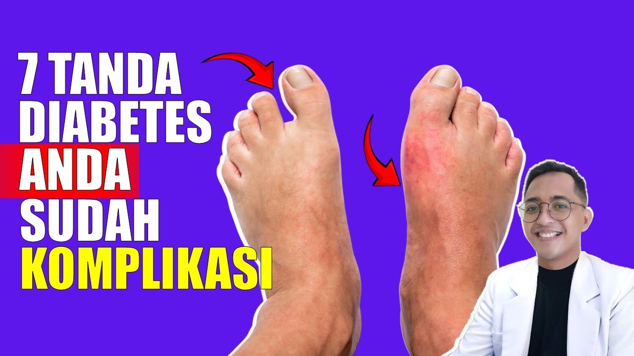 7 Gejala Komplikasi Diabetes yang Sering Diabaikan – Jangan Tunggu Terlambat!