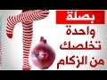 بصلة نيئة في الجوارب لعلاج الزكام