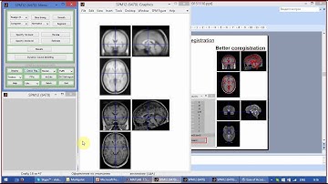 SPM12 (Kyiv 2015): part 3 - reorientation 3/3, coregistration 1/2