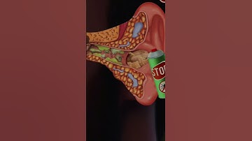 #shorts •GAMEPLAY • ANDROIDGAME, IOSGAME •ASMR Waxing Spa Makeover