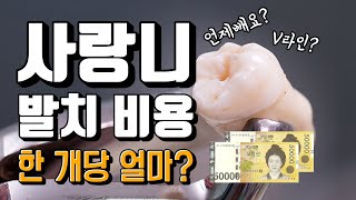 사랑니 발치 비용 완벽하게 정리합니다, 보험료 적용법! (feat.V라인 생기나요?)