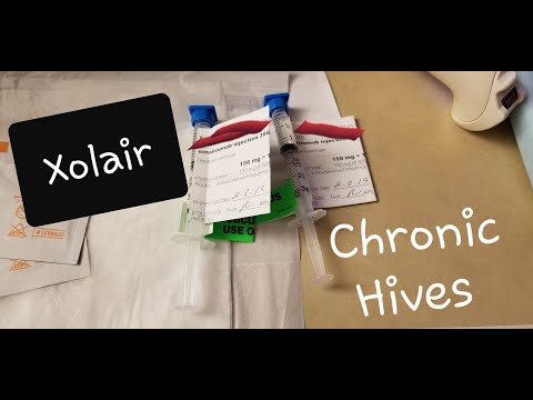 Xolair Injection for Hives! Chronic Urticaria Treatment!