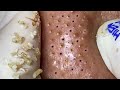 Satisfying and Relax Video with Hien Spa Beauty #03
