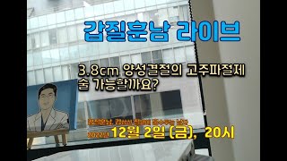 12/2 (금) 20:00 3.8cm 양성결절의 고주파 치료가 가능한가요?