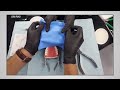 Rubber Dam Isolation Course Part 5 Dr Mostafa Taha Rubber Dam Isolation Course Part 5 Dr Mostafa Taha