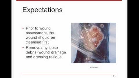 WoundRounds Webinar - Wound Assessment & Documentation: A Practical Guide