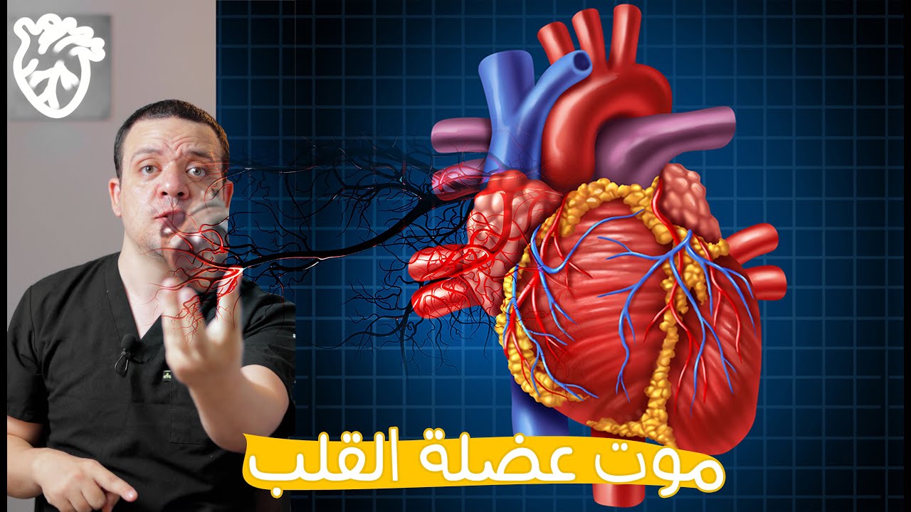 موت عضلة القلب 💔 IHD