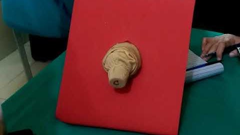 POP-Q Tutorial by Dr.Humera | #exam | #fcps | #osce | #prolapse | #clinical