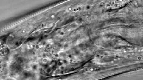 C. elegans moving in hard gelatin