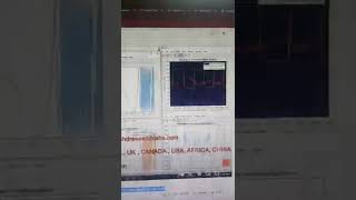 Apnea Detection using Electrocardiography (ECG) - Sleep Apnea - ECG - Bioengineering - MATLAB
