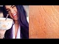 HOW TO GET RID OF STRETCH MARKS (Naturally + Fast) | DIY Stretch Mark Removal Serum 100% Works