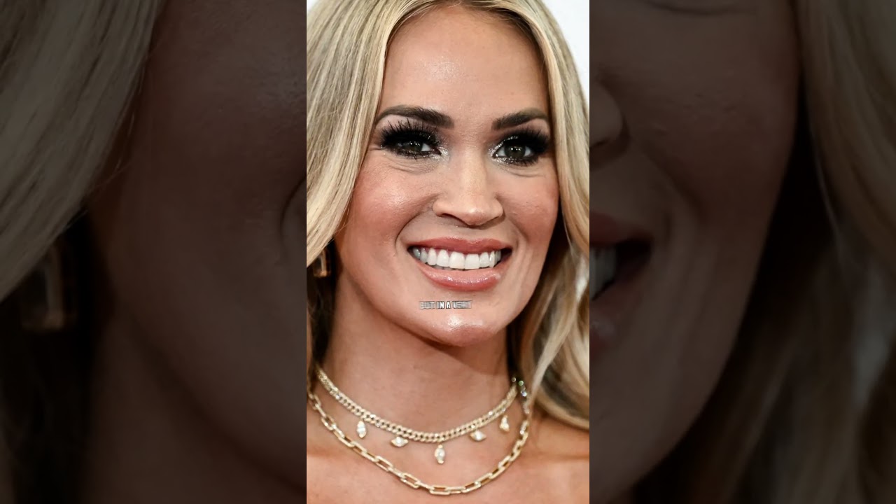 A Dive into Carrie Underwood’s Plastic Surgery #celebrity #doctor #plasticsurgery #carrieunderwood