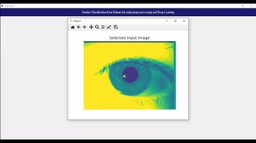 Deep Learning Based Gender and Age Estimation Through Iris Patterns