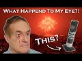 I ALMOST LOST MY EYE!