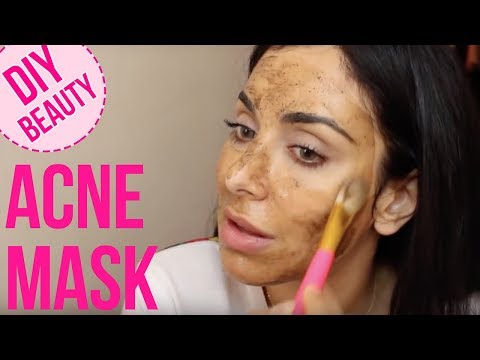 My Fav DIY Acne Miracle Mask!  خلطة طبيعيّة لمعالجة حبّ الشباب