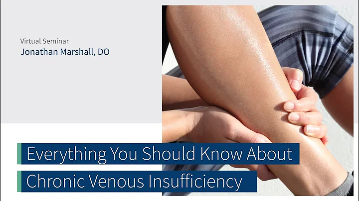 What You Should Know About Chronic Venous Insuffic...