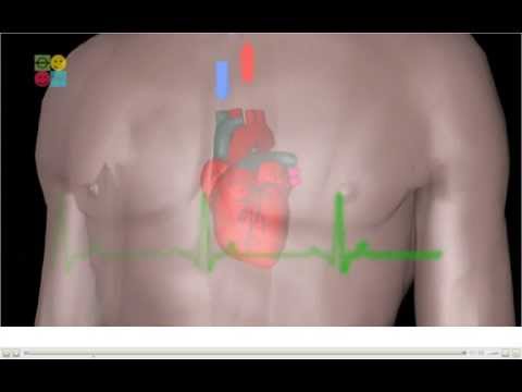 Video: Srdcová Zástava Psa - Liečba Zastavením Srdca Psa