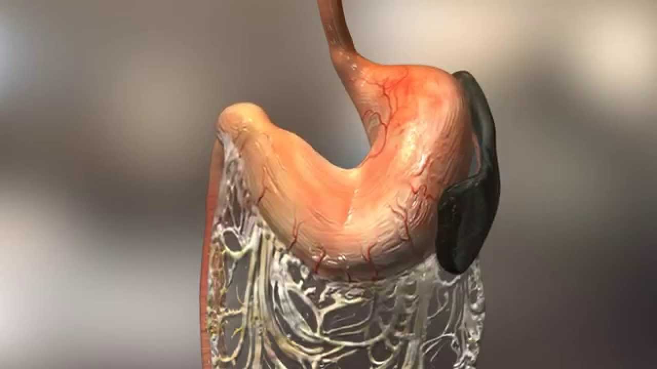 patterson veterinary dia client education video gastric make a signature