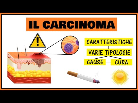 Video: Differenza Tra Cellule Basali E Cellule Squamose