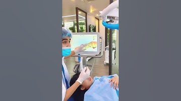 Phát hiện sâu kẽ răng một cách dễ dàng cùng công nghệ hiện đại của iTero tại #nhakhoahungcuong