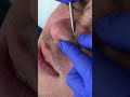 Мужчина и уход за лицом: чистка — не роскошь, а необходимость