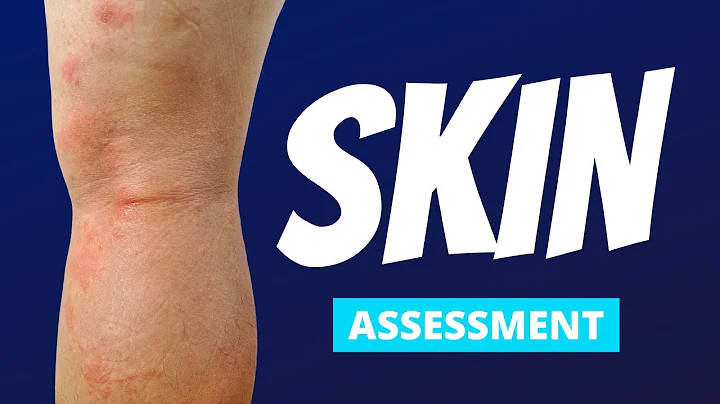 Skin Focused Nursing Assessment | The Most Common Findings Explained