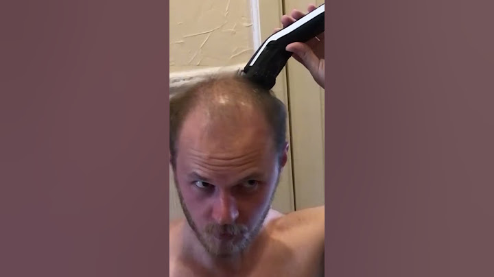 BALDING IN MY 20's Head Shave BEFORE/AFTER