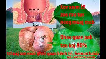 qhia tshuaj ntsuab zoo mob nqaij hlav nram qhov quav ริดสีดวงทวาร, bệnh trĩ, hemorrhoids