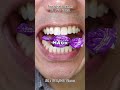 The Most Satisfying Chocolate and Candy ASMR Compilation 🍫🍬 #DoctorTristanPeh #Chocolate #Candy