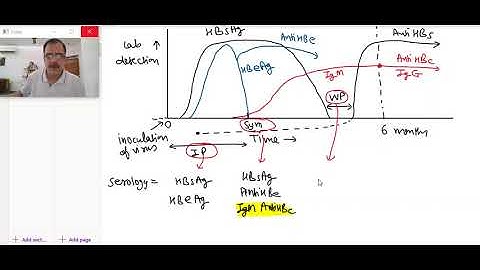 hepatitis B serology | Liver | Dr Arvind Kumar