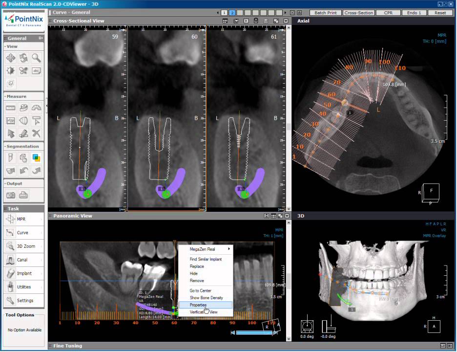 Realscan 2.0 pointnix 