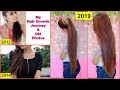 MY HAIR GROWTH JOURNEY- How To Grow Long Hair Fast | Rinkal Soni