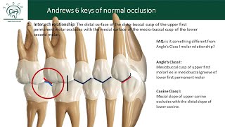 Andrew's 6 Keys of Normal Occlusion (Lesson 1 (1st key) )