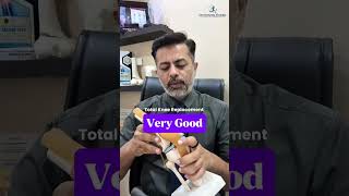 Is a Total Knee Replacement ALWAYS Necessary?