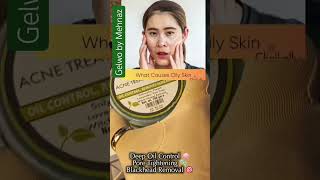 Acne Set Reviewin Pakistan#acne #skincare #acnetreatment #beautytips #glowingskin #pakistaniskincare
