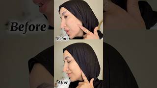 AXIS-Y PDRN gel toner انتي محتاجه المنتج ده