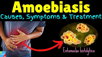 Amoebiasis | Amebiasis | Amoebic Dysentery – Symptoms, Causes, Treatment, Complications, Preventions