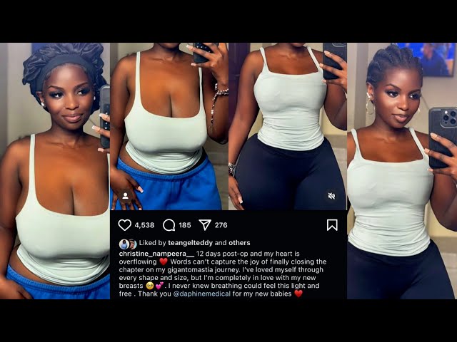 Detacha doesn't agree with Christine Nampeera's BBL B00bs transformation