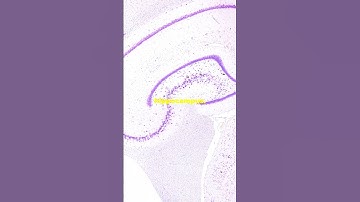 How Your Brain Stores Memories! 🧠 #trending #shorts #ytshorts #memory #brain #science