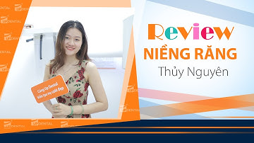 [Review niềng răng]: #35 Kết quả niềng răng của Thủy Nguyên