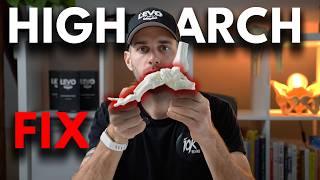 High Arch Problem You're Probably Fixing It Wrong