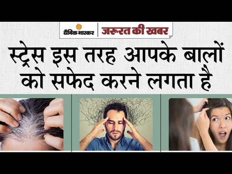 वीडियो: क्या तनाव के कारण बाल सफेद हो जाते हैं?