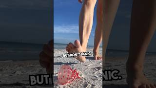 Stung by a jellyfish? Try this… #beach #summer #survival