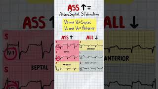 MI Localization ECG Mnemonic | USMLE Step 2 Cardiology High-Yield Review