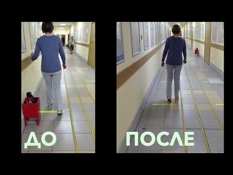Результат занятий на цикле корректировки ходьбы при рассеянном склерозе