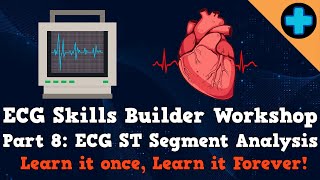 Electrocardiogram (ECG) Skills Builder Workshop Part 8: ST Segment Analysis