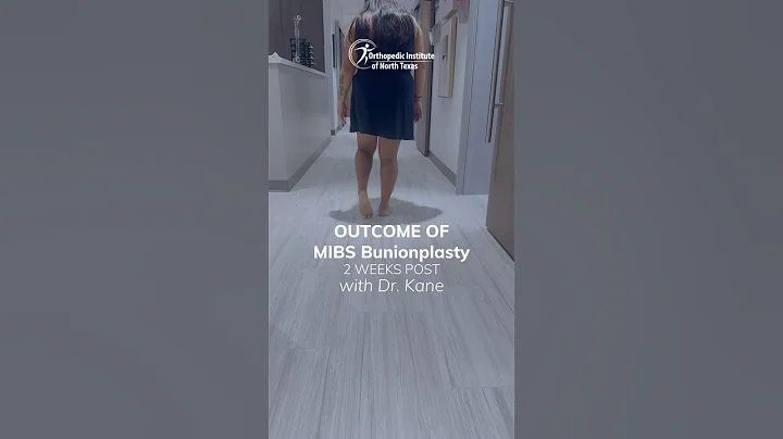 2 Weeks After Minimally Invasive Bunion Surgery | Dr. Justin Kane | Dallas Foot & Ankle Surgeon