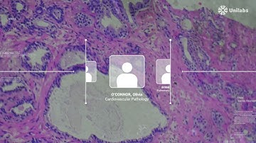AI: The future of pathology